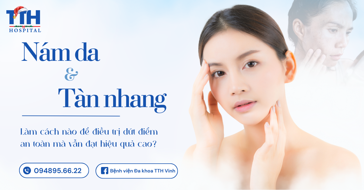 Điều Trị Nám Và Tàn Nhang Hiệu Quả